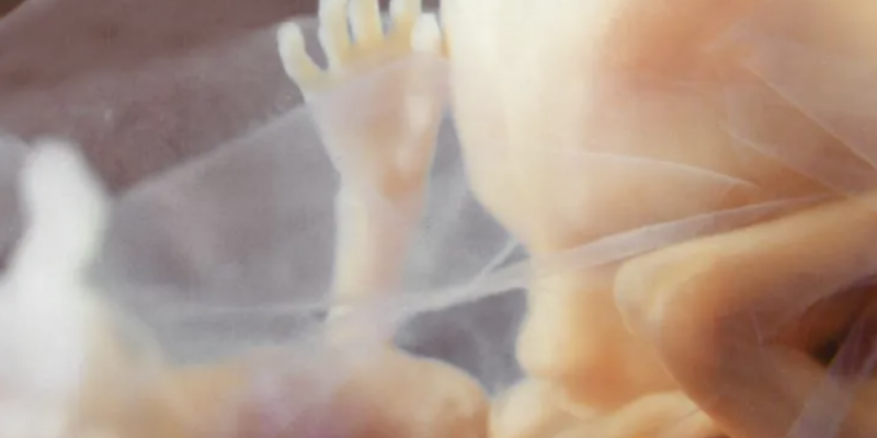Florida Bill Protecting Mothers of Unborn Children Gains Traction in Senate